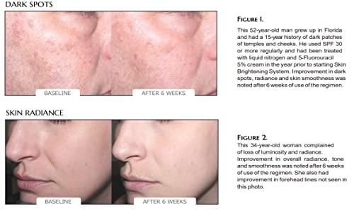 Merculine Skin Brightening System - Медицински клас - Осветляющий крем за лице - Намалява тъмните петна и фини